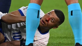 Килиан Мбаппе Еуро-2024 дебюттік матчында мұрнын сындырды